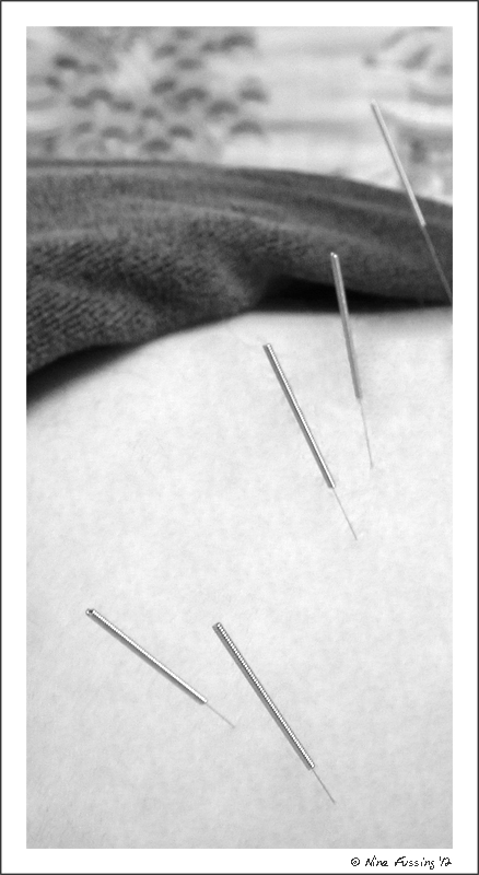C-20120624 Acupuncture (4) (JPG)