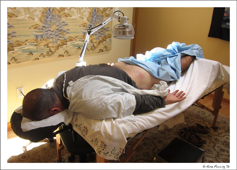 C-20120624 Acupuncture (8) (JPG)